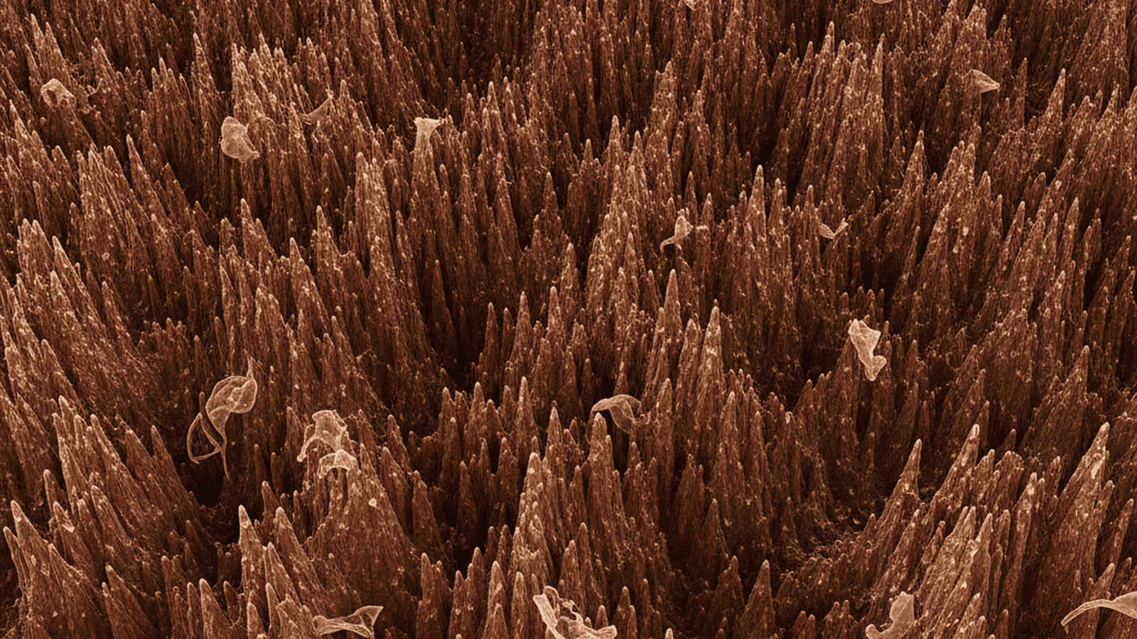 A microscopic view of nanostructured copper showing sharp, needle-like features designed to kill bacteria.